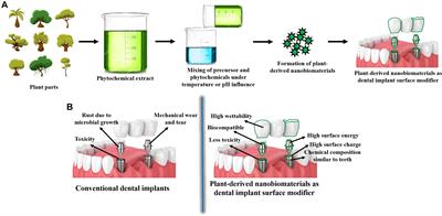 Plant-Derived Nanobiomaterials as a Potential Next Generation Dental Implant Surface Modifier